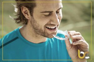 Invisalign Clear Aligners Northwich Dentist Announces Private Patient Appointments at Brunner Court Dental & Implant Practice