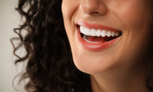 Smiles Dentistry Now Offering Comprehensive Dental Implants