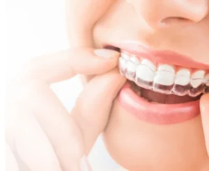 Invisible Braces Bradford Shipley Idle Private Dentist Dr Carl Taylor Recommends Treatment Consultations at Taylored Dental Care