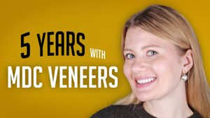 Maltepe Dental Clinic Reveals Minimal Prep Dental Veneers Dominate UK Patient Choices